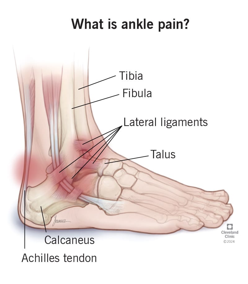 ankle-pain.jpg