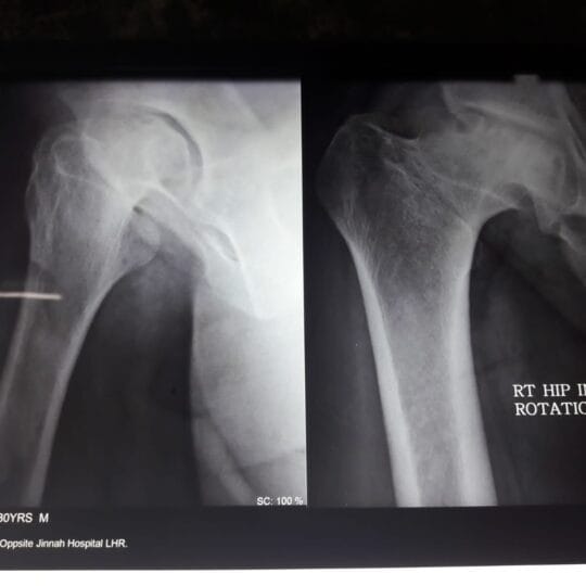 Orthopedic X-Ray Imaging Analysis | Bone & Joint Care