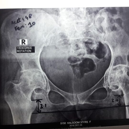 Orthopedic Bone X-Ray Imaging | Accurate Joint Diagnosis
