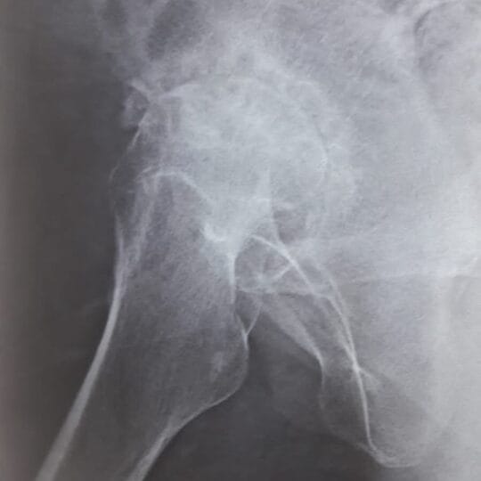 Professional orthopedic surgery in sterile operating room