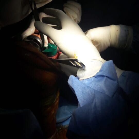 Dr. Tahseen Riaz performing complex orthopedic surgery