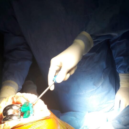 Knee ligament repair surgery performed by orthopedic surgeon
