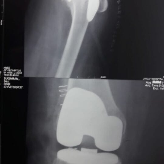 Orthopedic surgeon performing advanced knee joint treatment