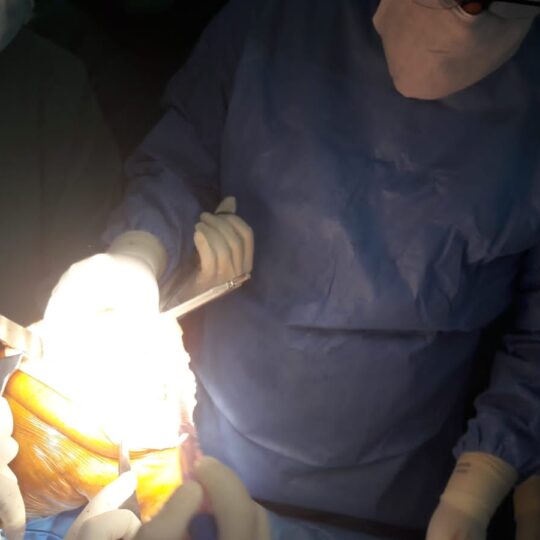 Professional knee reconstruction surgery in Lahore hospital