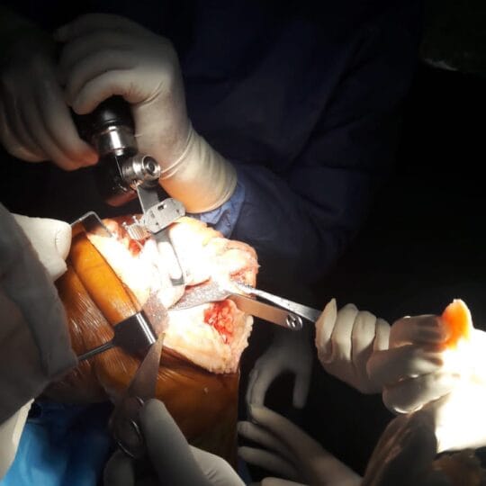 Dr. Tahseen Riaz leading orthopedic surgical team