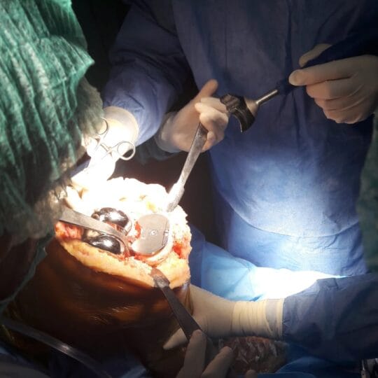 Orthopedic surgeon performing ligament repair surgery