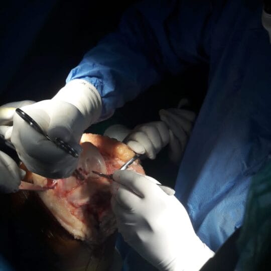 Advanced orthopedic knee operation by leading surgeon in Lahore